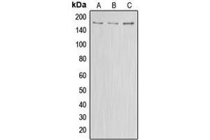 Western blot analysis of ABCA8 expression in HEK293T (A), Raw264. (ABCA8 anticorps  (Center))