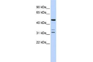 WB Suggested Anti-HTRA4 Antibody Titration: 0. (HTRA4 anticorps  (Middle Region))