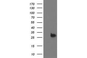 Western Blotting (WB) image for anti-Deoxythymidylate Kinase (Thymidylate Kinase) (DTYMK) antibody (ABIN1497921) (DTYMK anticorps)