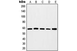Western blot analysis of c-Myc expression in HEK293A (A), Jurkat (B), K562 (C), HeLa (D), NIH3T3 (E) whole cell lysates. (c-MYC anticorps  (C-Term))