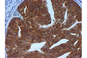 Image no. 3 for anti-Metalloproteinase Inhibitor 2 (TIMP2) antibody (ABIN1501393) (TIMP2 anticorps)