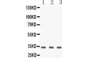 Anti-Calponin antibody,Western blotting All lanes: Anti -Calponin  at 0.