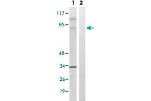 Western blot analysis of Lane 1: Untreated HeLa cell lysates, Lane 2: Synthesized peptide treated HeLa cell lysates reacted with MDM4 (phospho S367) polyclonal antibody  at 1:500-1:3000 dilution. (MDM4-binding Protein anticorps  (pSer367))
