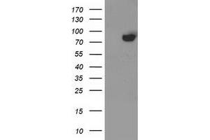 Western Blotting (WB) image for anti-Acyl-CoA Synthetase Short-Chain Family Member 2 (ACSS2) antibody (ABIN1496428) (ACSS2 anticorps)