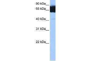 WB Suggested Anti-TTC12 Antibody Titration: 0. (TTC12 anticorps  (C-Term))
