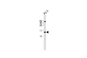 All lanes : Anti-FUNDC2 Antibody (C-term) at 1:500 dilution Lane 1: PC-3 whole cell lysate Lysates/proteins at 20 μg per lane. (FUNDC2 anticorps  (C-Term))