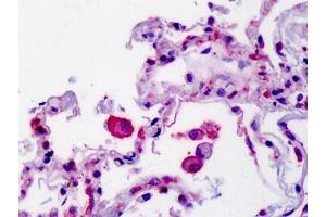 Human Lung: Formalin-Fixed, Paraffin-Embedded (FFPE)