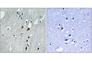 Immunohistochemistry analysis of paraffin-embedded human brain, using PDCD4 (Phospho-Ser457) Antibody.