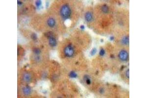 Used in DAB staining on fromalin fixed paraffin-embedded Liver tissue (HDAC6 anticorps  (AA 1038-1204))