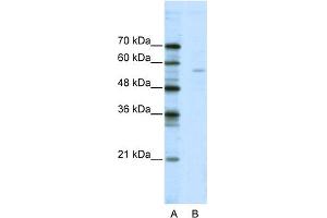 WB Suggested Anti-ELK1 Antibody Titration:  2. (ELK1 anticorps  (N-Term))