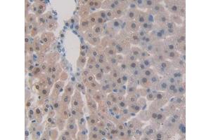Used in DAB staining on fromalin fixed paraffin- embedded Kidney tissue