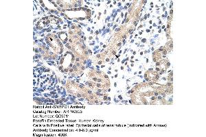 Rabbit Anti-SNRPD1 Antibody  Paraffin Embedded Tissue: Human Kidney Cellular Data: Epithelial cells of renal tubule Antibody Concentration: 4. (SNRPD1 anticorps  (N-Term))