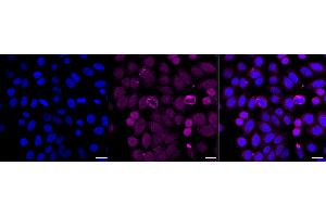 Immunocytochemical staining of HepG2 cells with Cyclin dependent kinase 1 antibody (ABIN7798205), 1:1,000). (Recombinant CDK1 anticorps)
