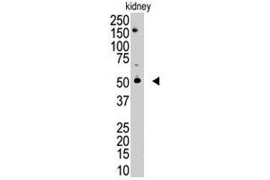 The RNF216 polyclonal antibody  is used in Western blot to detect RNF216 in mouse kidney tissue lysate. (RNF216 anticorps  (C-Term))