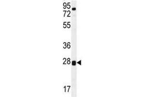 TOR2A antibody western blot analysis in human placenta tissue lysate. (TOR2A anticorps  (AA 194-221))