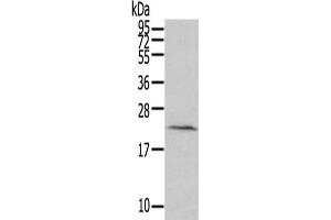 Gel: 12 % SDS-PAGE,Lysate: 40 μg,Primary antibody: ABIN7190949(HINT3 Antibody) at dilution 1/200 dilution,Secondary antibody: Goat anti rabbit IgG at 1/8000 dilution,Exposure time: 2 minutes (HINT3 anticorps)