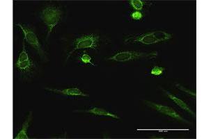 Immunofluorescence of purified MaxPab antibody to ECHS1 on HeLa cell.