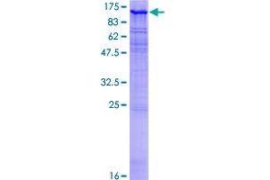 Image no. 1 for Microtubule Associated serine/threonine Kinase 2 (MAST2) (AA 1-792) protein (GST tag) (ABIN1310420)