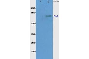 Lane 1: Mouse Liver, lysates Lane 2: Mouse Brain probed with Rabbit Anti-c-Raf(Ser338/Tyr340) Polyclonal Antibody, Unconjugated  at 1:200 overnight at 4˚C.