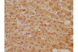 IHC image of ABIN7152961 diluted at 1:300 and staining in paraffin-embedded human liver tissue performed on a Leica BondTM system. (BLVRB anticorps  (AA 2-206))