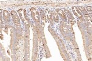 Immunohistochemistry analysis of paraffin-embedded mouse small intestine using NCKAP1 (ABIN7074784) at dilution of 1: 8000