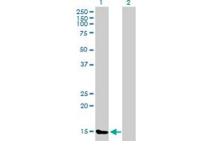 Western Blot analysis of TXNL4B expression in transfected 293T cell line by TXNL4B MaxPab polyclonal antibody. (TXNL4B anticorps  (AA 1-149))