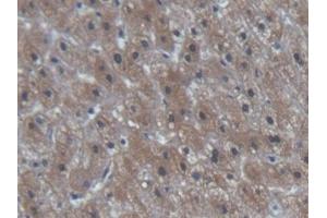 Detection of NT-ProBNP in Human Liver Tissue using Polyclonal Antibody to N-Terminal Pro-Brain Natriuretic Peptide (NT-ProBNP)