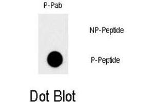 Dot blot analysis of MYC (phospho T58) polyclonal antibody  on nitrocellulose membrane. (c-MYC anticorps  (pThr58))