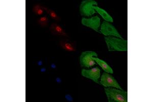 ABIN7094707 and ABIN7098758 staining  cells by IF/ICC. (HAND2 anticorps  (Internal Region))
