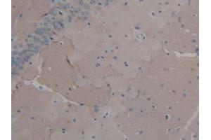 IHC-P analysis of Mouse Brain Tissue, with DAB staining. (FGF2 anticorps  (AA 10-154))