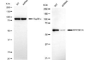 Western blotting analysis using PPP2R1B antibody (ABIN7800022).
