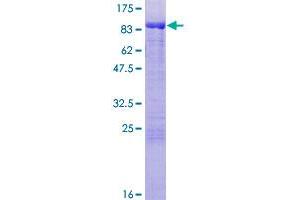 Image no. 1 for Mahogunin, Ring Finger 1 (MGRN1) (AA 1-576) protein (GST tag) (ABIN1310888)