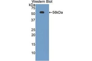 Western blot analysis of the recombinant protein. (CD46 anticorps  (AA 157-365))