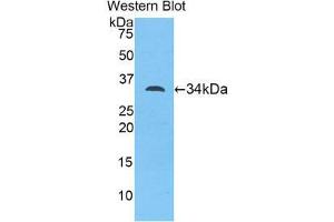 Western Blotting (WB) image for anti-Myosin ID (MYO1D) (AA 581-847) antibody (ABIN1078392) (Myosin ID anticorps  (AA 581-847))