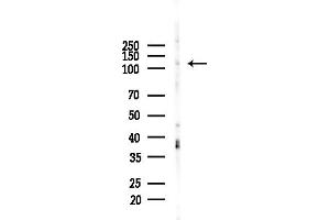 Western blot analysis of lysates from EC304 cells, using MCF2L Antibody at 1/1000 dilution.