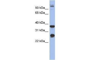 WB Suggested Anti-BGN Antibody Titration: 0.