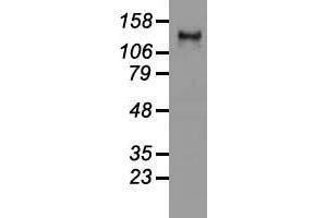 Western blot analysis of 35 µg of cell extracts from human (HeLa) cells using anti-L1CAM antibody. (L1CAM anticorps)