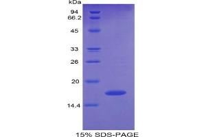 SDS-PAGE of Protein Standard from the Kit (Highly purified E. (Pleiotrophin Kit CLIA)