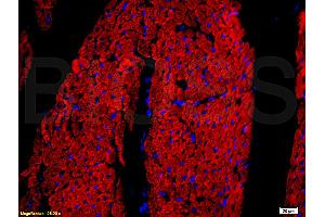 Formalin-fixed and paraffin embedded rat heart tissue labeled with Rabbit Anti-DOG-1/TMEM16A Polyclonal Antibody, Unconjugated (ABIN704216) at 1:200 followed by conjugation to the secondary antibody and DAB staining.