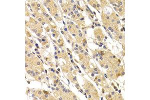 Immunohistochemistry of paraffin-embedded human stomach using TNNI3 antibody at dilution of 1:100 (x400 lens).
