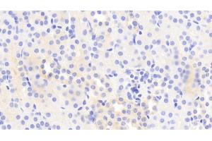 Detection of MYO1E in Mouse Kidney Tissue using Polyclonal Antibody to Myosin IE (MYO1E)