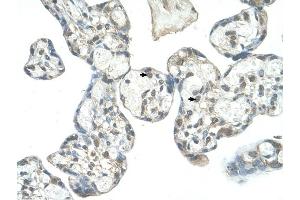 anti-EPS8-Like 1 (EPS8L1) (N-Term) antibody