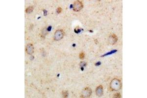 Immunohistochemical analysis of PSMD11 staining in human brain formalin fixed paraffin embedded tissue section. (PSMD11 anticorps)