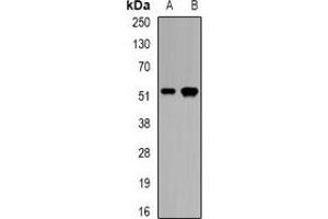 Western blot analysis of CALCOCO2 expression in mouse pancreas (A), rat skeletal muscle (B) whole cell lysates. (CALCOCO2 anticorps)