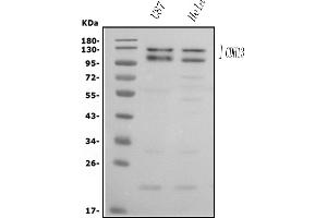 Western blot analysis of H Cadherin/CDH13 using anti-H Cadherin/CDH13 antibody (ABIN7600095).