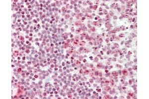 Human Tonsil: Formalin-Fixed, Paraffin-Embedded (FFPE).