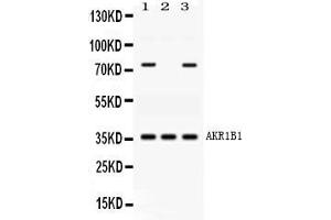 Western blot analysis of AKR1B1 expression in rat cardiac muscle extract ( Lane 1), human placenta extract ( Lane 2) and HELA whole cell lysates ( Lane 3). (AKR1B1 anticorps  (AA 228-316))