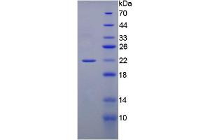 SDS-PAGE analysis of active recombinant Rat GREM1. (GREM1 Protéine)