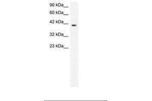 Image no. 3 for anti-Matrix Metallopeptidase 19 (MMP19) (AA 56-105) antibody (ABIN6735807) (MMP19 anticorps  (AA 56-105))