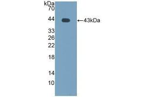 Detection of Recombinant MCP2, Bovine using Polyclonal Antibody to Monocyte Chemotactic Protein 2 (MCP2) (CCL8 anticorps  (AA 1-99))